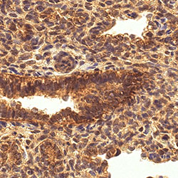sars-cov-2 gene expression in a human fetus